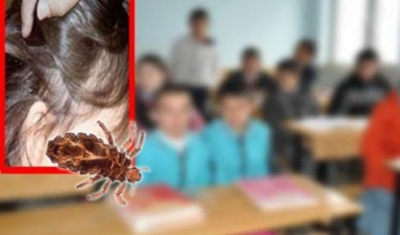 Gaziantep'te bazı okullarda bit salgını